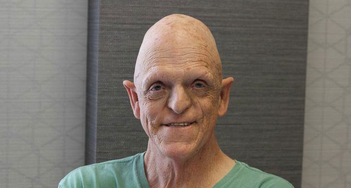 Michael Berryman