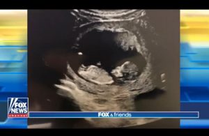 Jedediah published her pregnancy during Fox & Friends Show