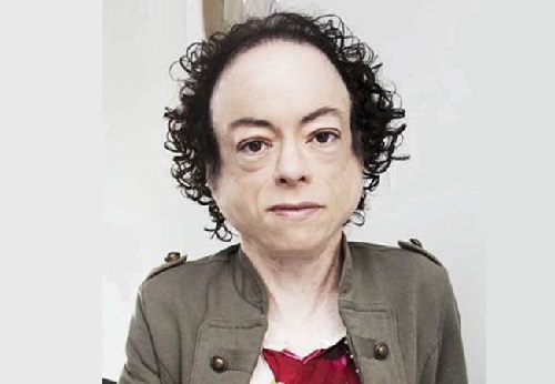 Liz Carr Age, Partner, Married, Husband, Children, Net Worth & Wiki